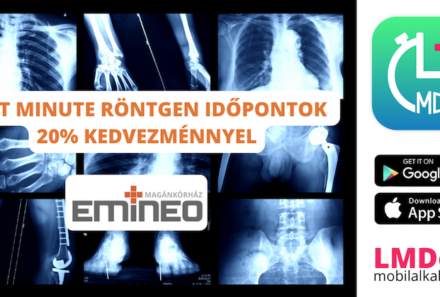 Röntgenidőpontok 20% kedvezménnyel az LMDoki Webappon is!